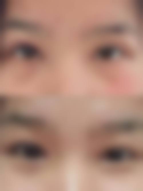 九、武汉尊丽整形医疗美容门诊部真实的患者评价