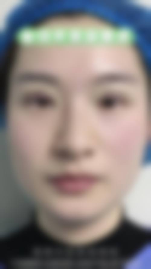 二、范秀针擅长项目