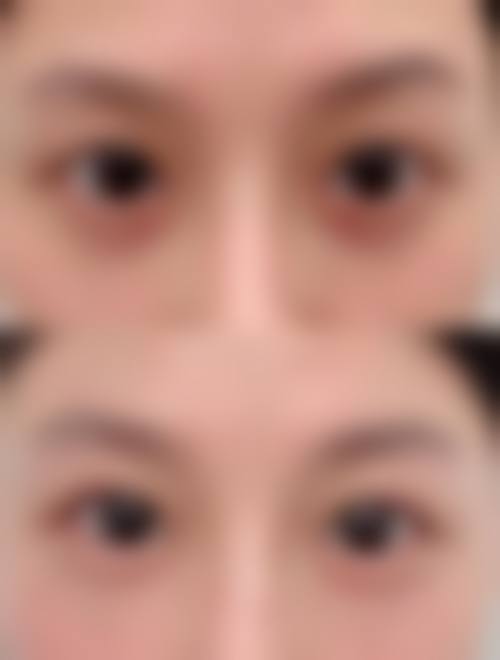 八、宁波海曙亚植医疗美容门诊部真实的患者评价