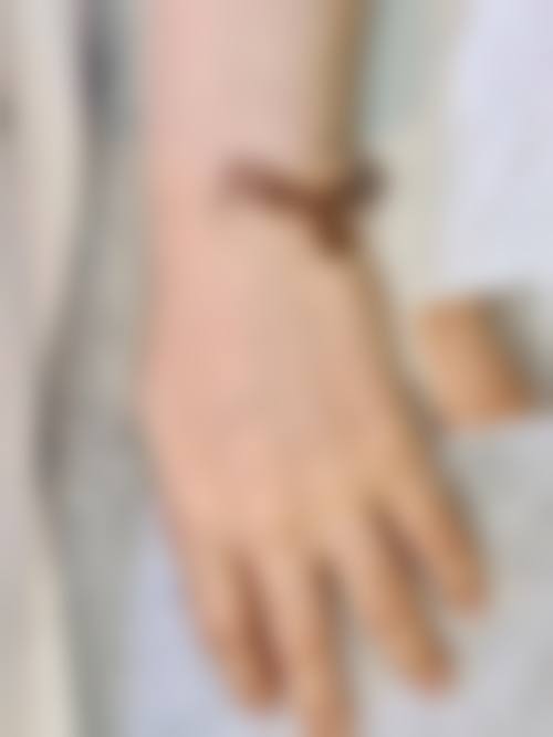 四、中山陈星海中医和西医结合医院皮肤美容科特色项目