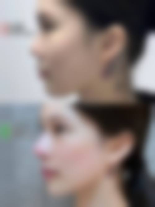 七、上海宏康医院私密整形科预约方式