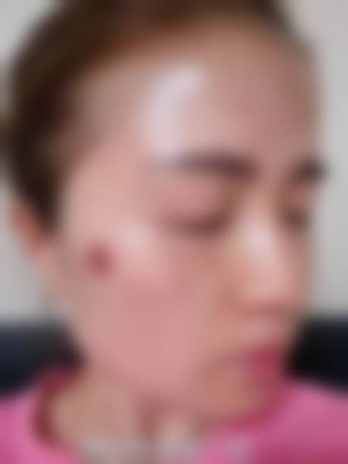 四、韩国PHD皮肤科特色项目