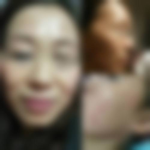 八、中山陈星海中医和西医结合医院皮肤美容科真实的患者评价