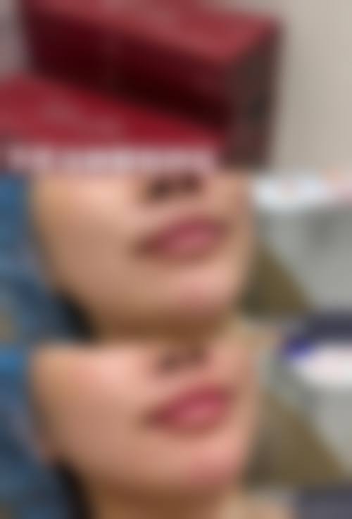 五、韩国PHD皮肤科价格表