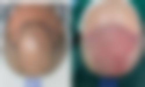 八、成都青羊首瑞植发医院真实的患者评价