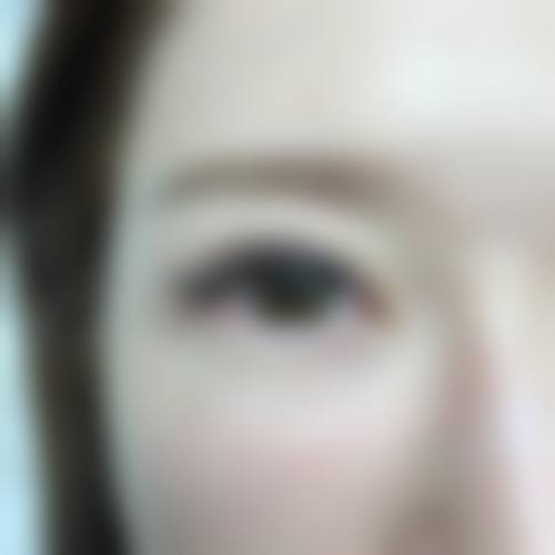 三、保定熙朵植发诊疗项目有哪些？