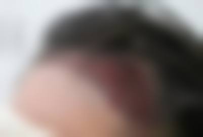 二、保定熙朵植发怎么样？