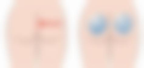 四、成都青羊首瑞植发医院特色项目