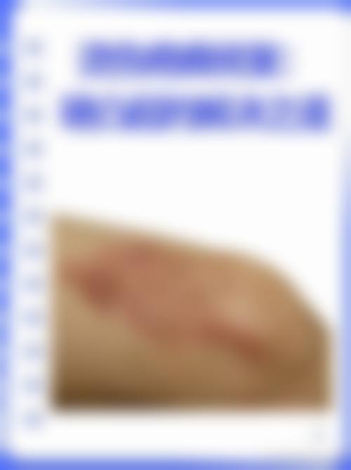 四、保定熙朵植发特色项目