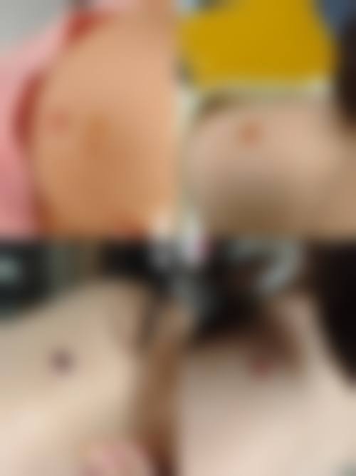 二、成都青羊首瑞植发医院怎么样？