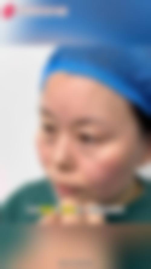 四、北京军区总医院皮肤激光整形美容特色项目