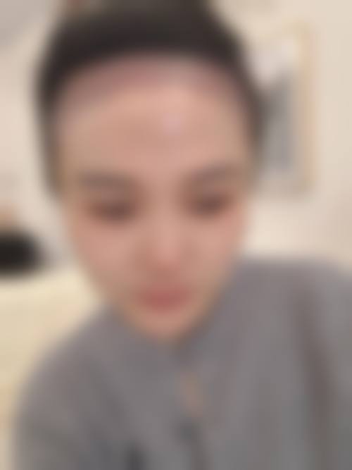 五、成都青羊首瑞植发医院价格表