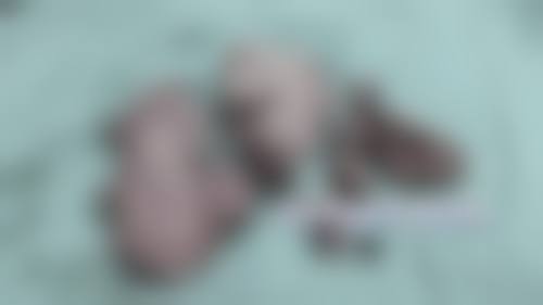 八、武汉尊丽整形医疗美容门诊部预约方式