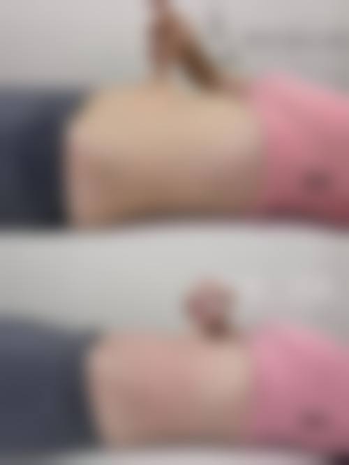 二、北京军区总医院皮肤激光整形美容怎么样？