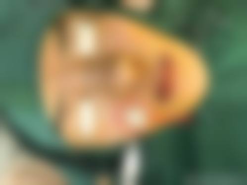 八、洛阳雅美嘉整形医院真实的患者评价