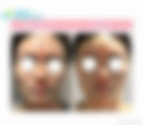 二、青岛幸芳医疗美容诊所怎么样？