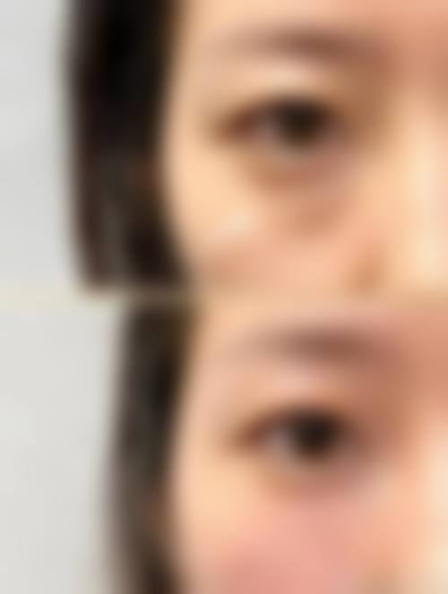 九、内蒙古紫洁医疗美容医院真实的患者评价