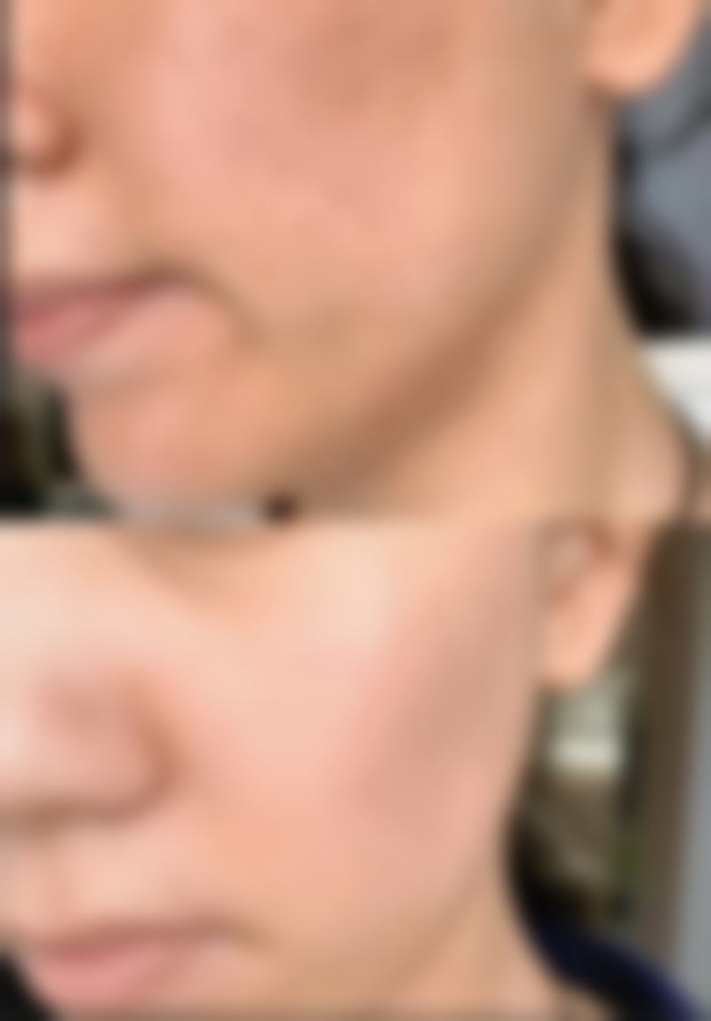 一、怎样去眼袋又快又好的小窍门之了解眼袋成因