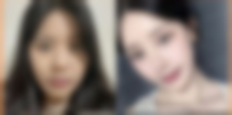 三、常见治疗脸上疤痕的方法