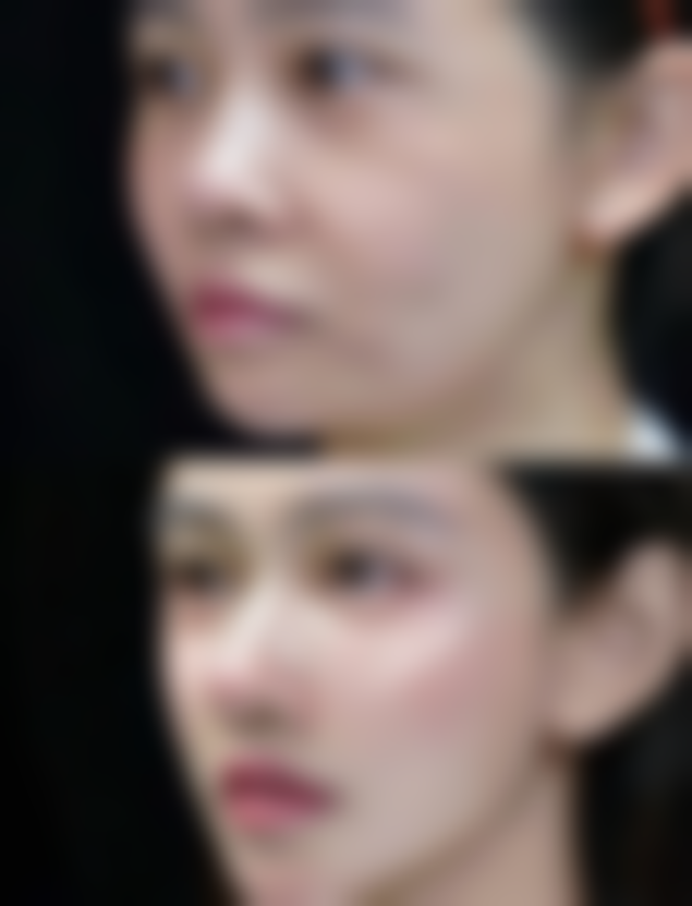 九、成都西部中西医结合医院整形科真实的患者评价