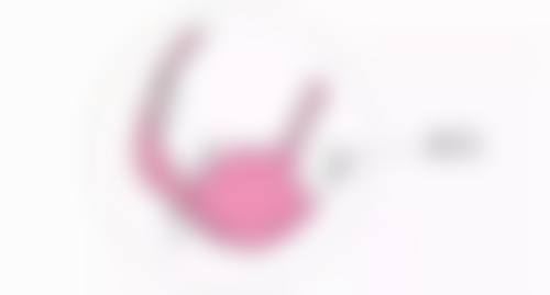 四、双眼皮多久修复期：术后护理建议