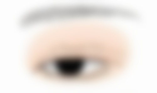 四、不同手术方式与割双眼皮抽脂的关系