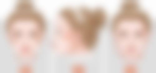 二、割双眼皮抽脂的成效及优势展现