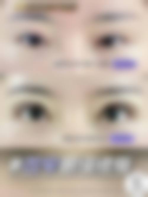 四、哈尔滨嫒尚美整形医院特色项目