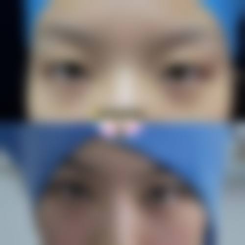 八、西安名一易美医疗美容诊所真实的患者评价