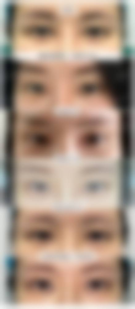 三、西安名一易美医疗美容诊所诊疗项目有哪些？