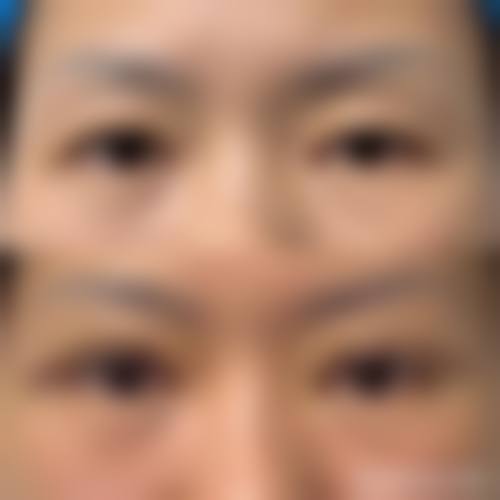 四、临沂杨加峰医疗美容门诊部特色项目