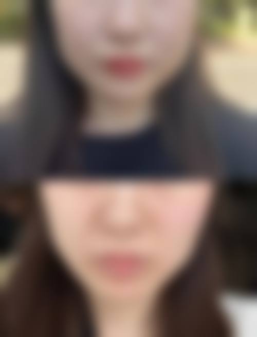 八、Toxnfill医院弘大新村店真实的患者评价