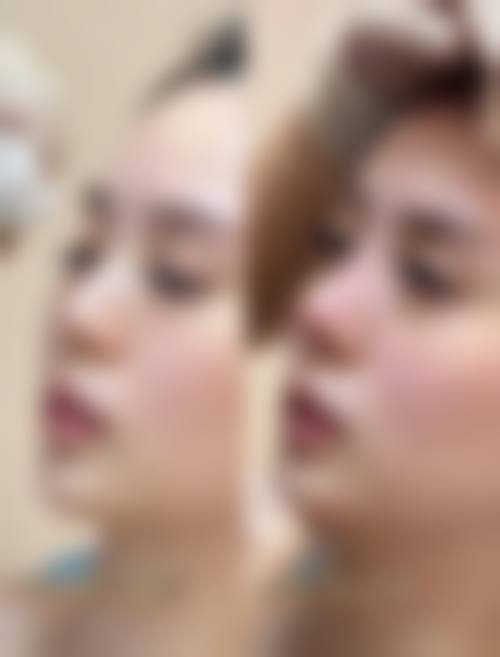 五、洛阳协和医疗美容医院价格表