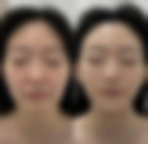 三、安徽天鹅湖整形医院诊疗项目有哪些？