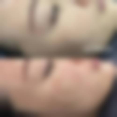 八、東京表参道BeLumi真实的患者评价