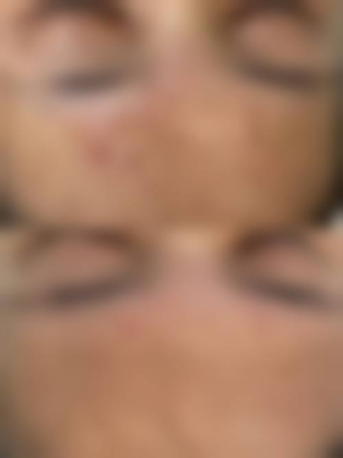 三、東京表参道BeLumi诊疗项目有哪些？