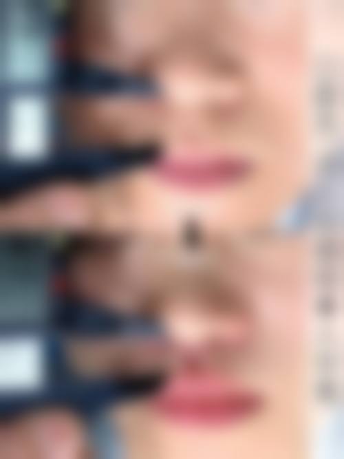 二、新乡华美美容医院怎么样？