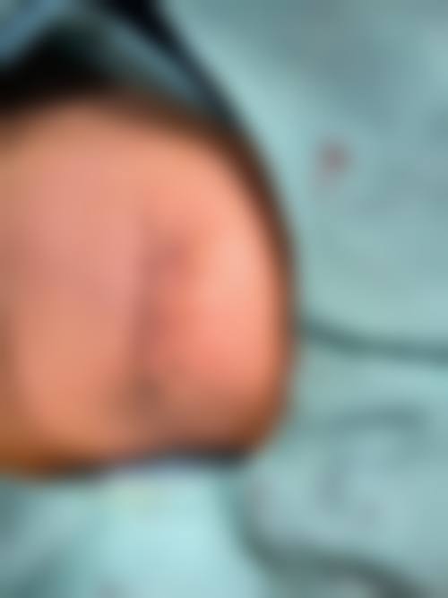 八、上海氧术星颜（倍思特）医疗美容门诊部真实的患者评价