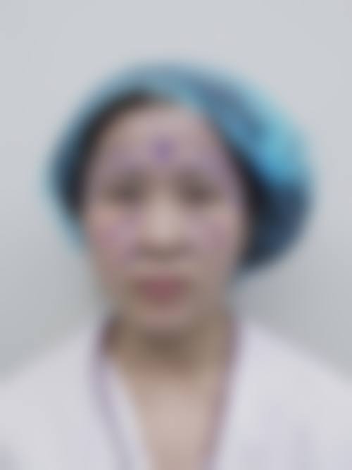 八、徐州唯尔美辰医疗美容门诊部真实的患者评价