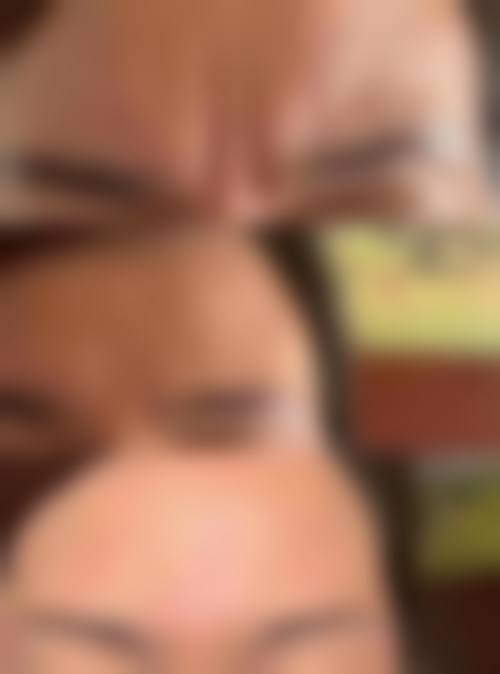 八、秋叶原Skin附属真实的患者评价