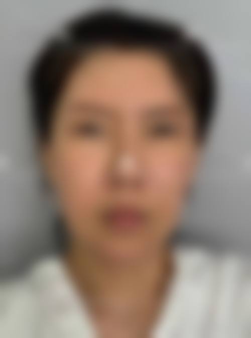 八、新乡华美美容医院真实的患者评价