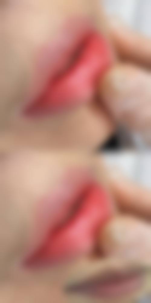 八、天津美日秀医疗美容门诊部真实的患者评价