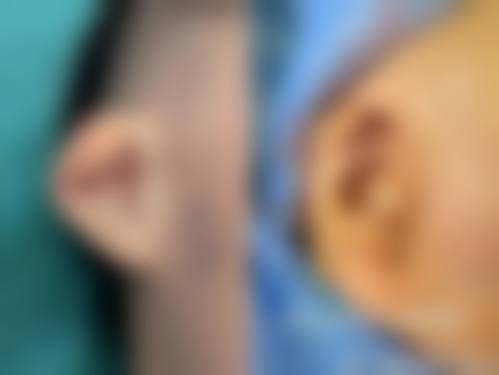 四、武汉华亚美容医院特色项目