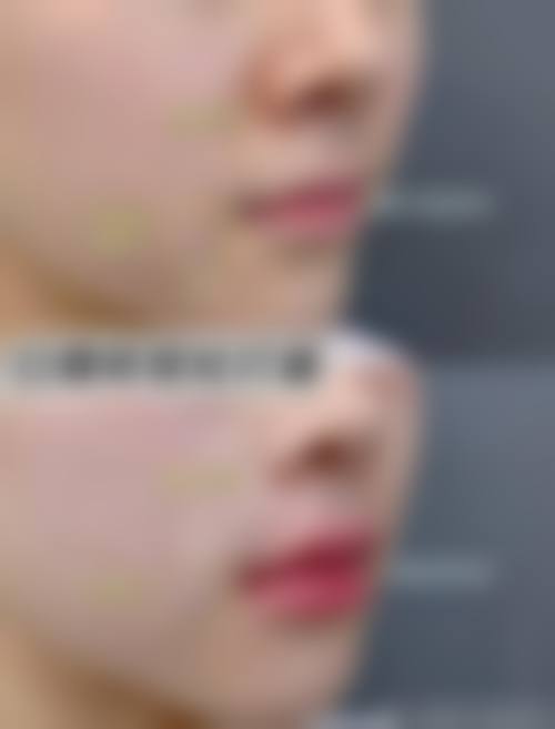 二、東京表参道BeLumi怎么样？