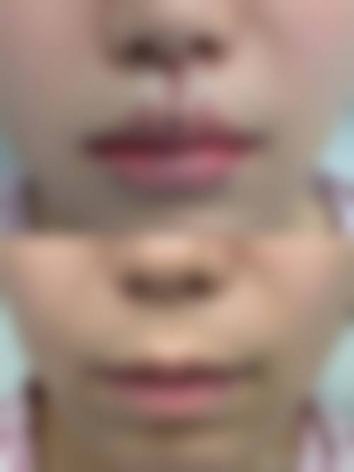 三、株洲宇芳姬整形医院诊疗项目有哪些？