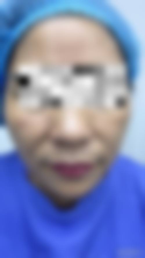 五、上海氧术星颜（倍思特）医疗美容门诊部价格表