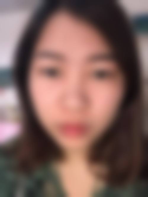 二、株洲宇芳姬整形医院怎么样？