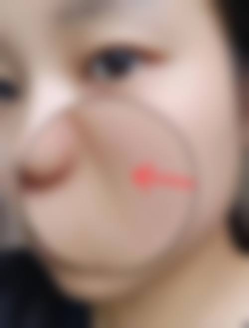 二、安徽天鹅湖整形医院怎么样？