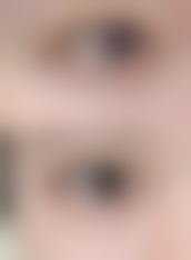 二、非手术临时修饰方法