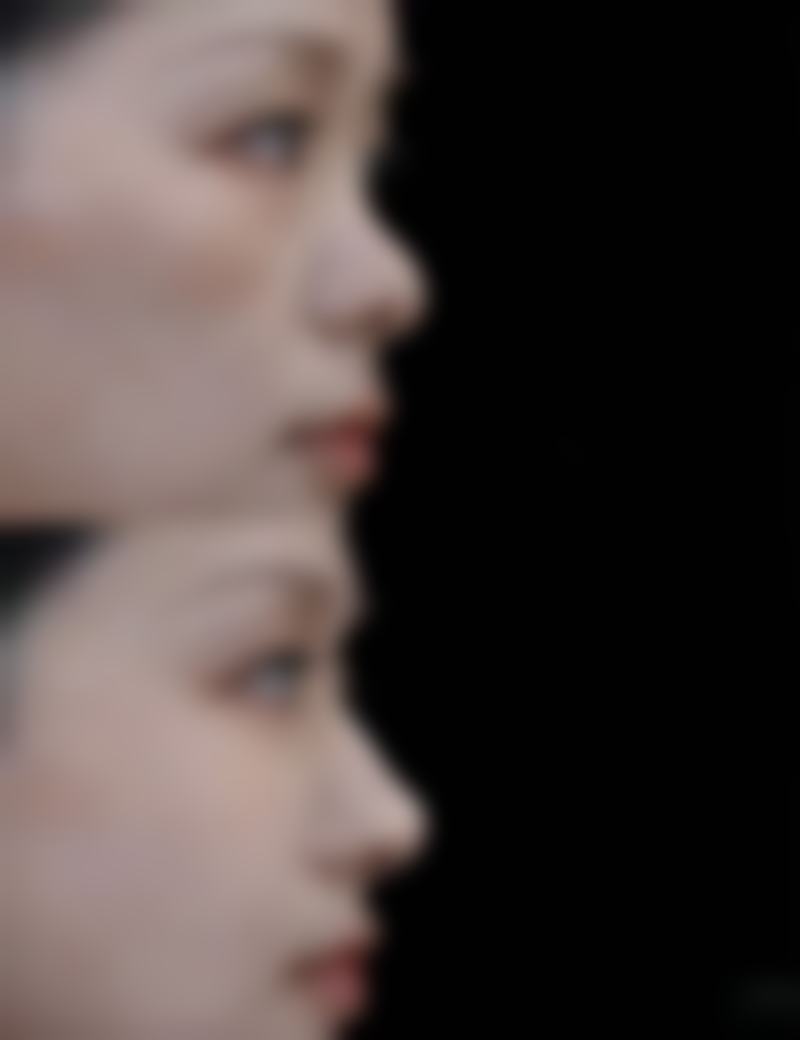 二、寻找有效的黑眼圈眼袋滴眼液